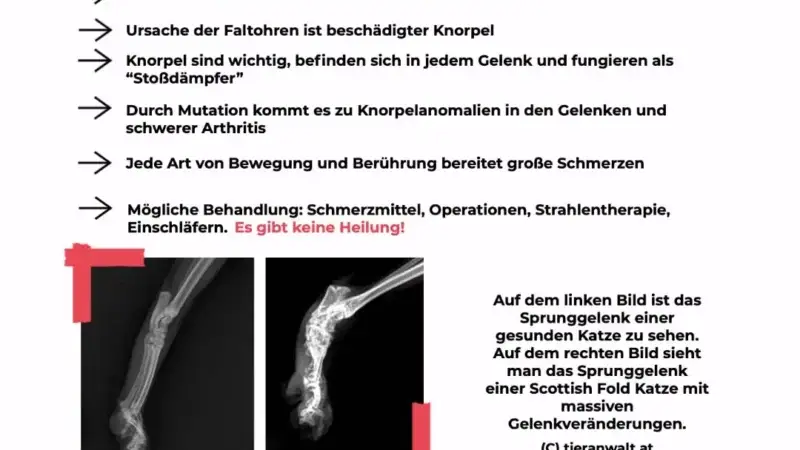 OCD (Osteochondrosis Dissecans)