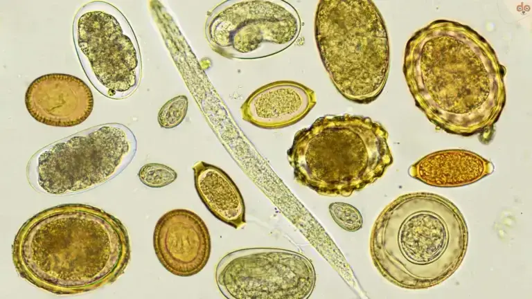 Parasiten
