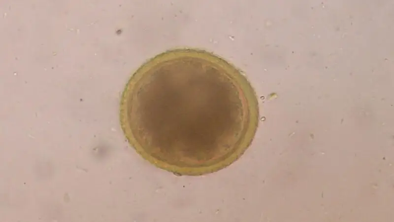 Toxocara Canis