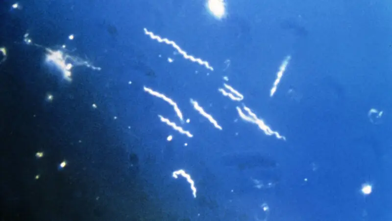 Borrelia-Burgdorferi-Bakterium