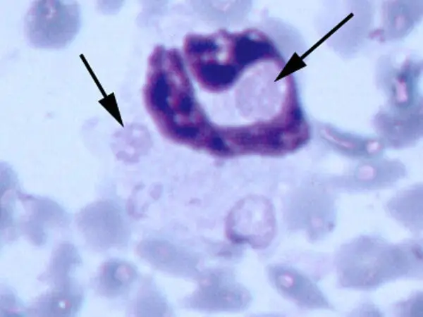 Ehrlichia ewingii
