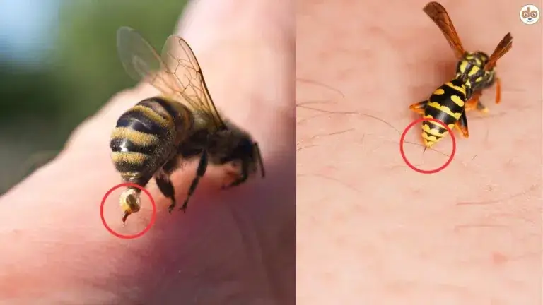 Bienenstich Wespenstich auf menschlicher Haut