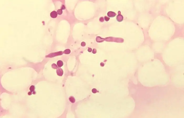 Malassezia-Hefen