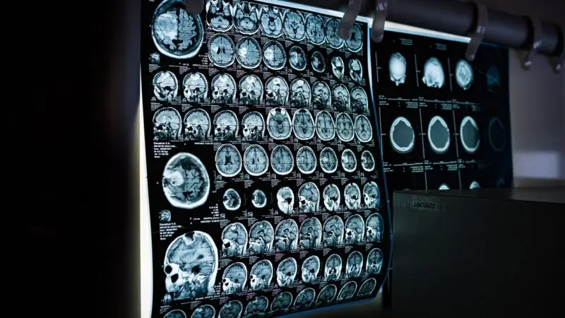Elektrodiagnostik (Neurologie)