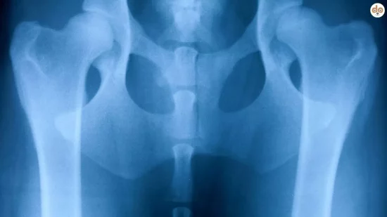 Gelenkprobleme bei Hunden